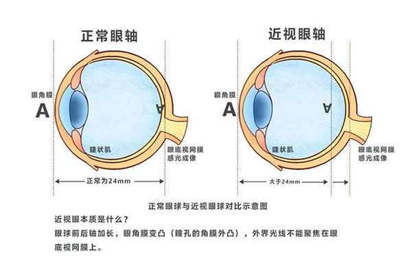 发育因素